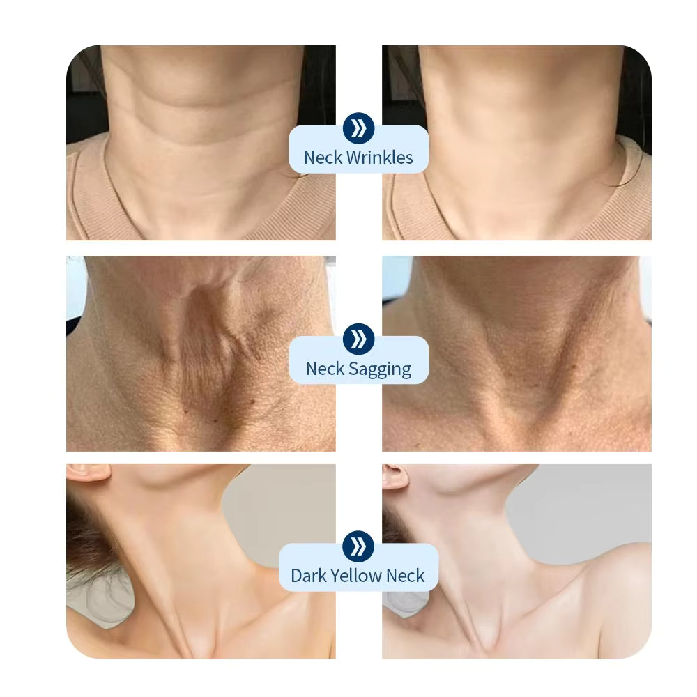NeckSculpt LED Collagen Rejuvenation Mask