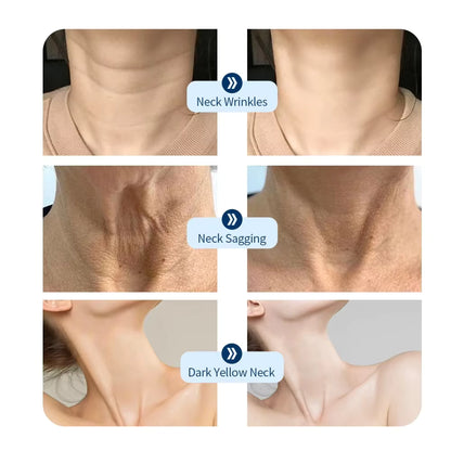 NeckSculpt LED Collagen Rejuvenation Mask